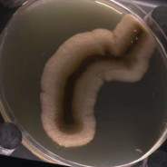 A vida invisível dos micróbios… em um museu!